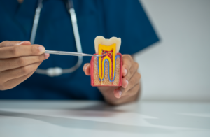 parodontitis-blogbeitrag