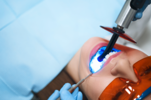 zahn-bleaching-tipps